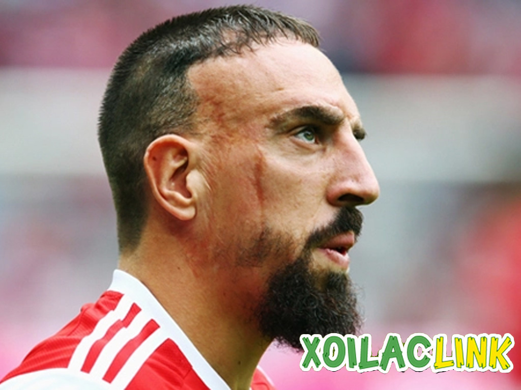 ribery-voi-vet-seo-tren-mat